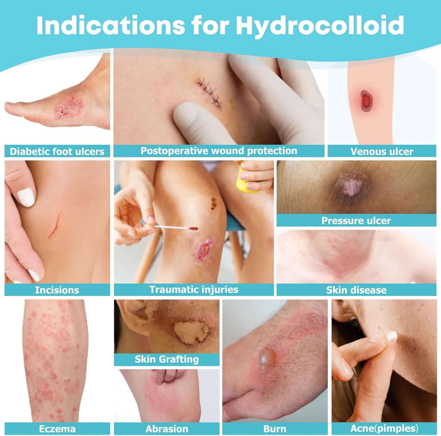 EasyHeal™ Medical Roll