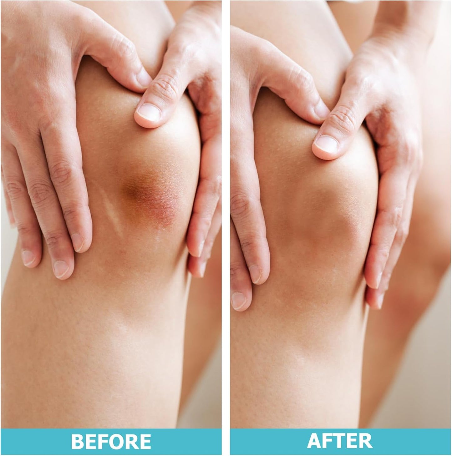 EasyHeal™ Medical Roll